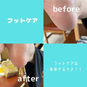 フットケアのビフォーアフターの画像